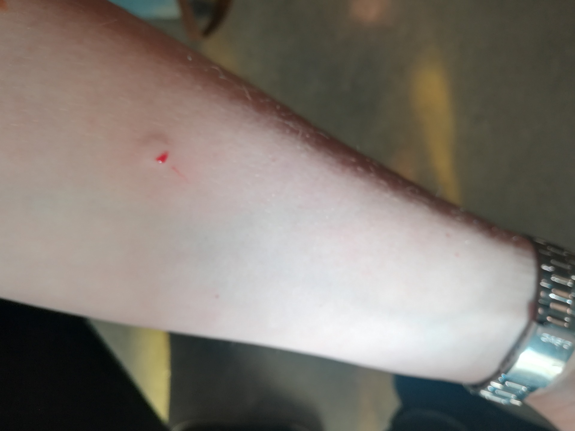 I  bled :(